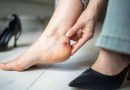 नए जूतों के छालों से राहत देंगे ये घरेलू नुस्खे, दर्द होगा दूर